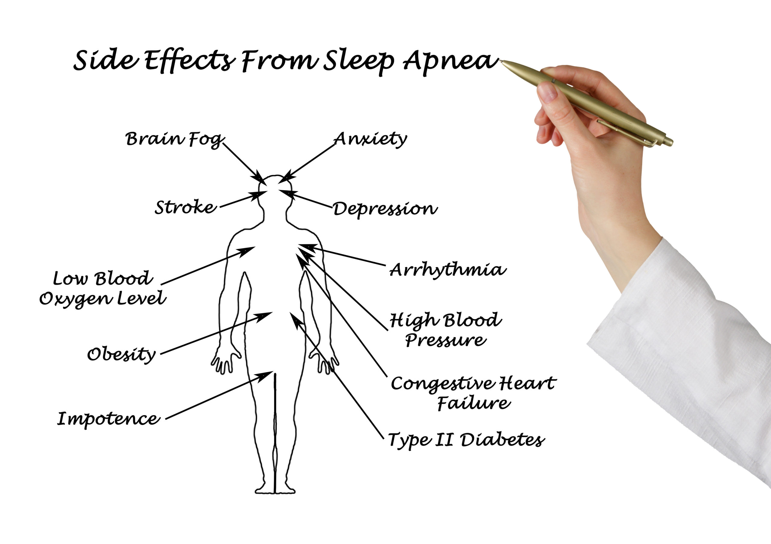 sleep apnea heart cardiovascular disease