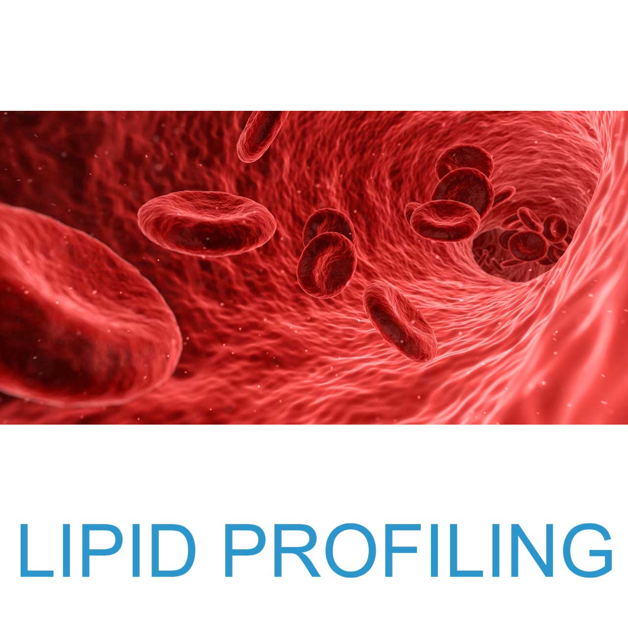 Lipid Profiling