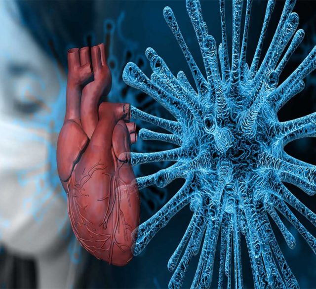 Covid19_CardiovascularDisease